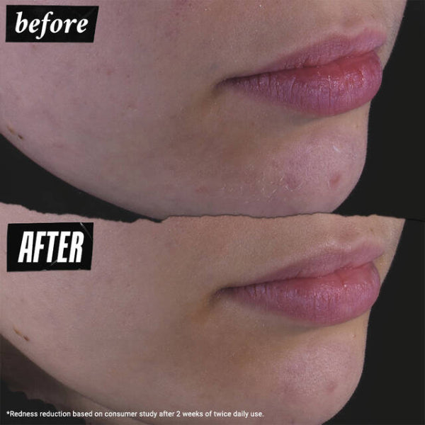 Kiehl's Calendula Herbal Extract Toner Alcohol Free