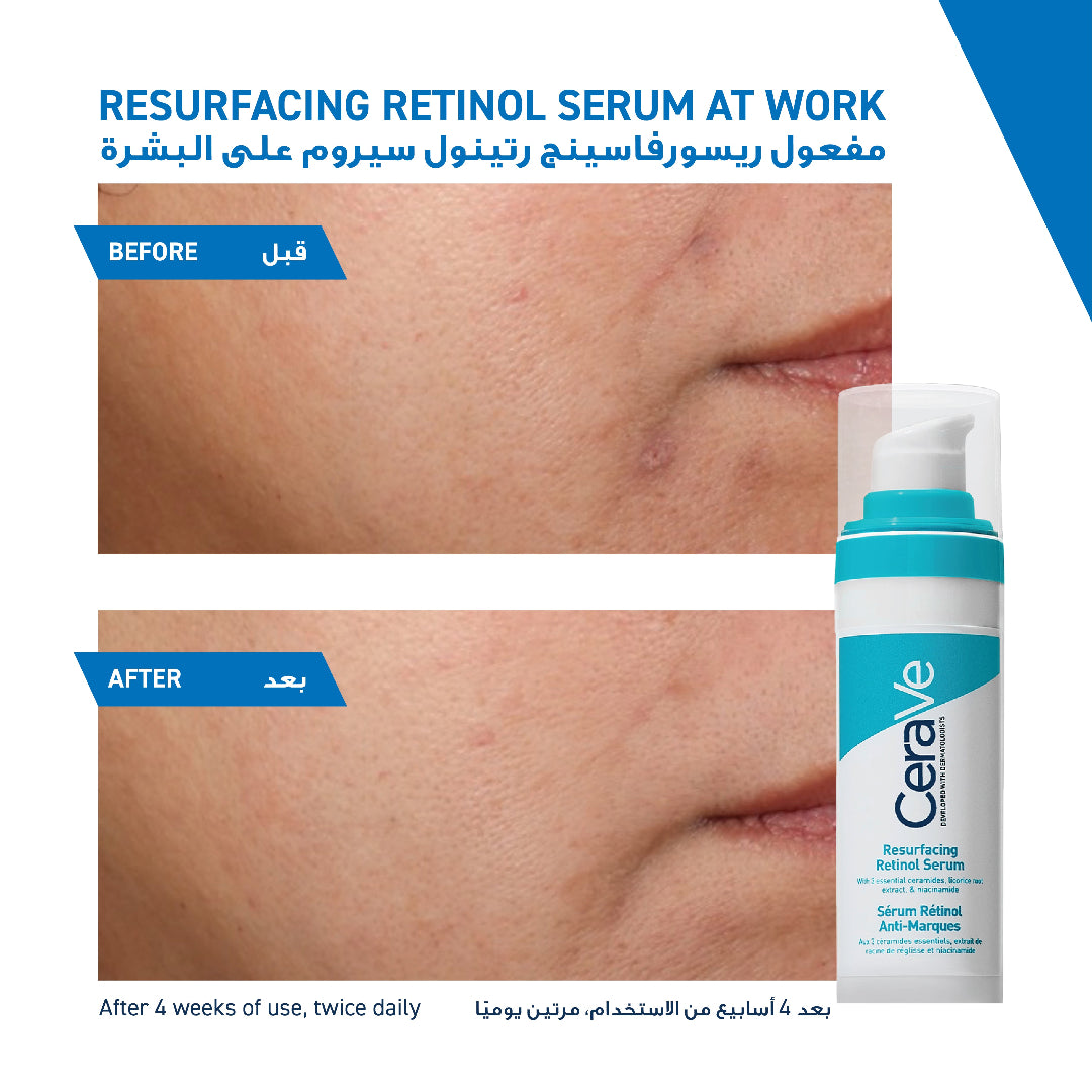 CeraVe Resurfacing Retinol Serum - Before & After