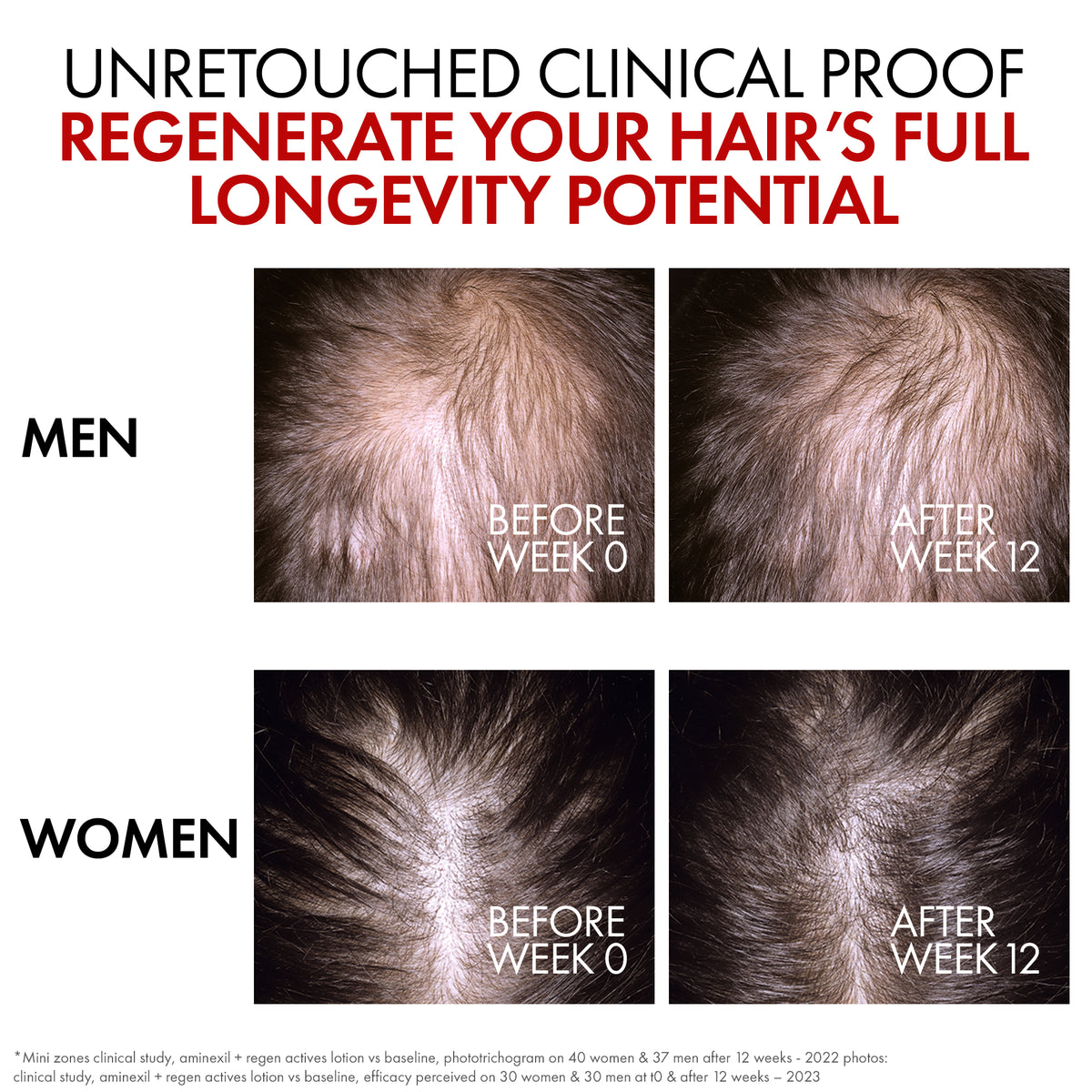 Dercos Aminexil Clinical R.E.G.E.N. Booster 90ml
