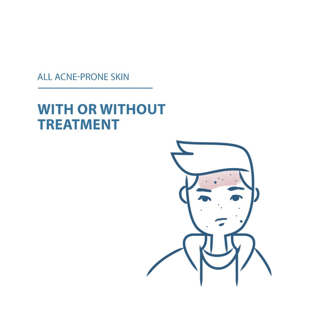 Keracnyl Foaming Gel