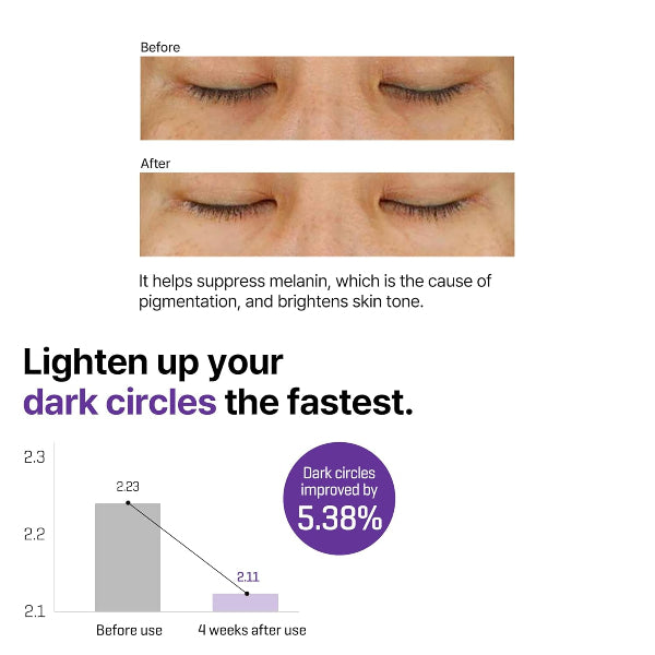 Retinol Intense Advanced Triple Action Eye Cream - Before & After