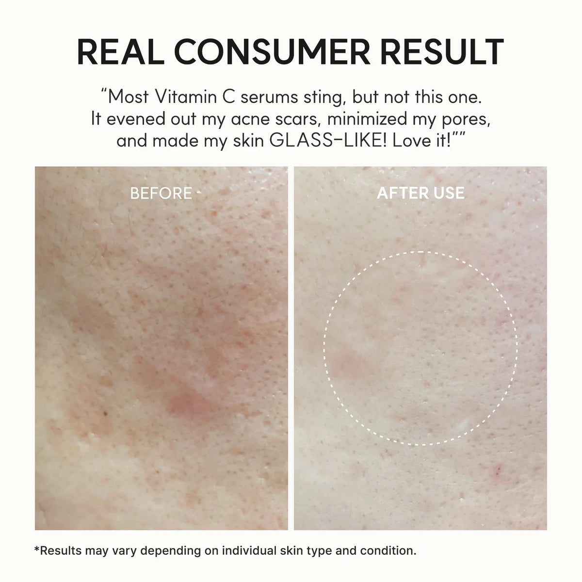 Before and after skin comparison with text about a vitamin C serum's effectiveness.