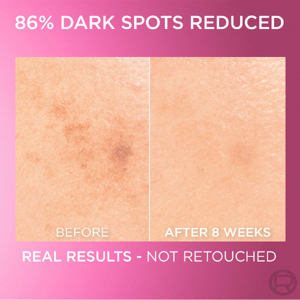 L'Oréal Paris Glycolic Bright Serum with 8% [Melasyl ™ + Glycolic Acid + Niacinamide] face serum for Dark Spots & Brightening 30ml