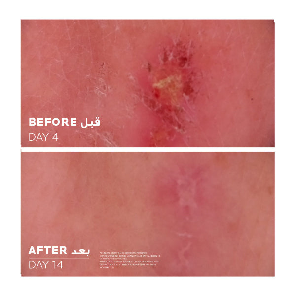 La Roche-Posay Cicaplast Baume B5+ Ultra Reparing Soothing Balm