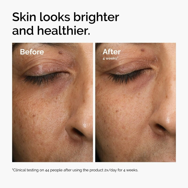 Multi-Antioxidant Radiance Serum